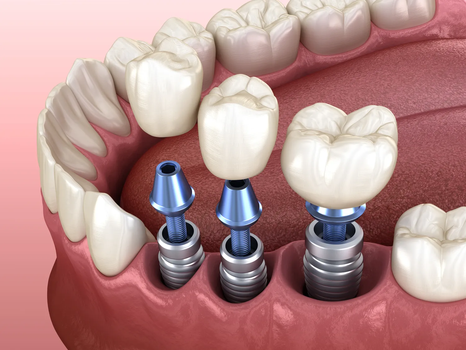 Jak pokonać lęk przed dentystą?